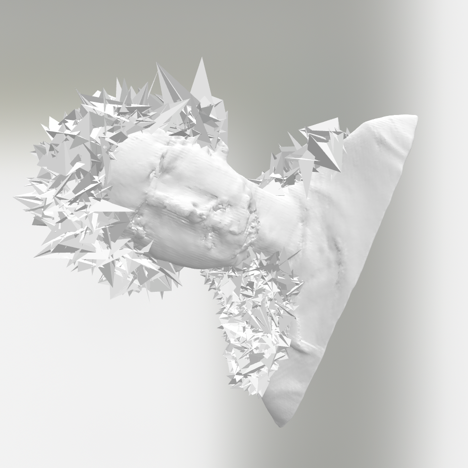 A bust of myself with a spike infection
